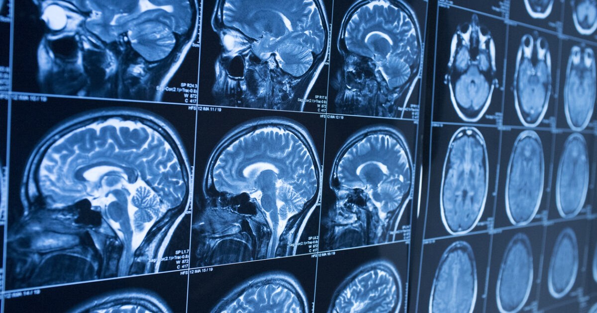 Brainmri